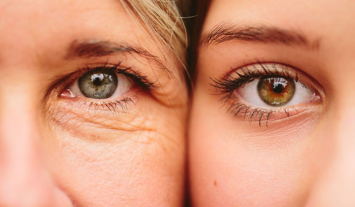 目の周りの老化の兆候